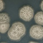 Bacteriën in je Septische Put